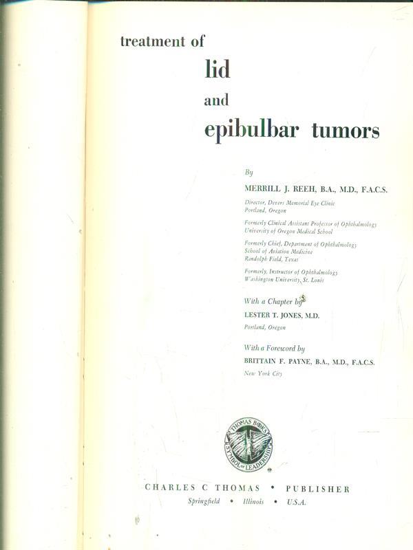 treatment of lid and epibulbar tumors