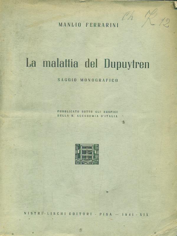 La malattia del Dupuytren