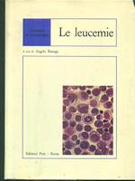 Le leucemie