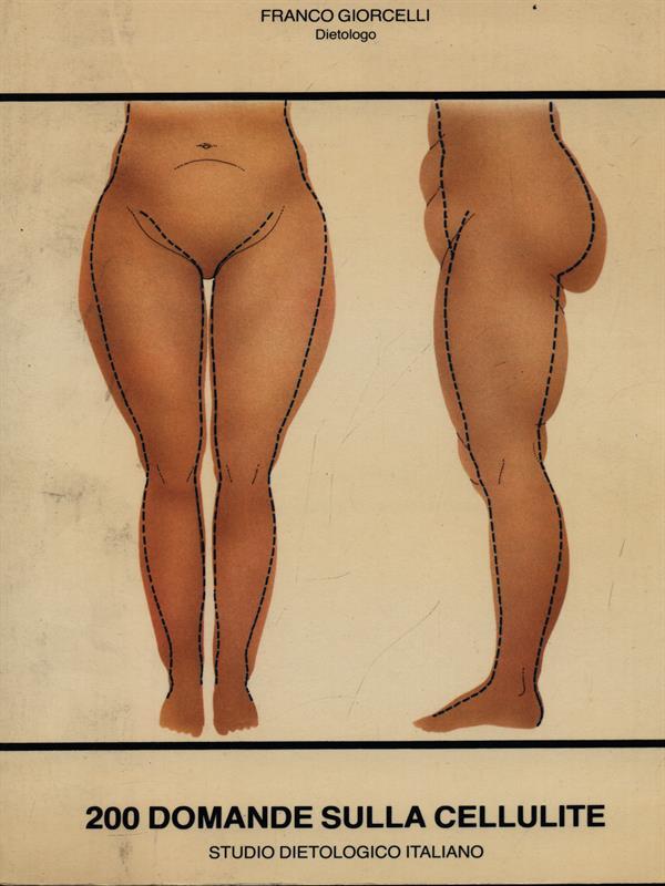 200 domande sulla cellulite