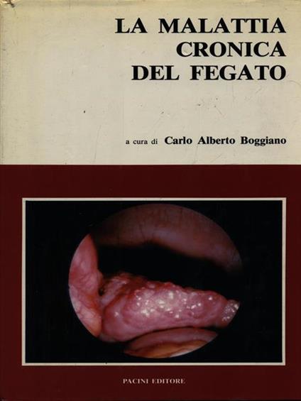 La malattia cronica del fegato - copertina