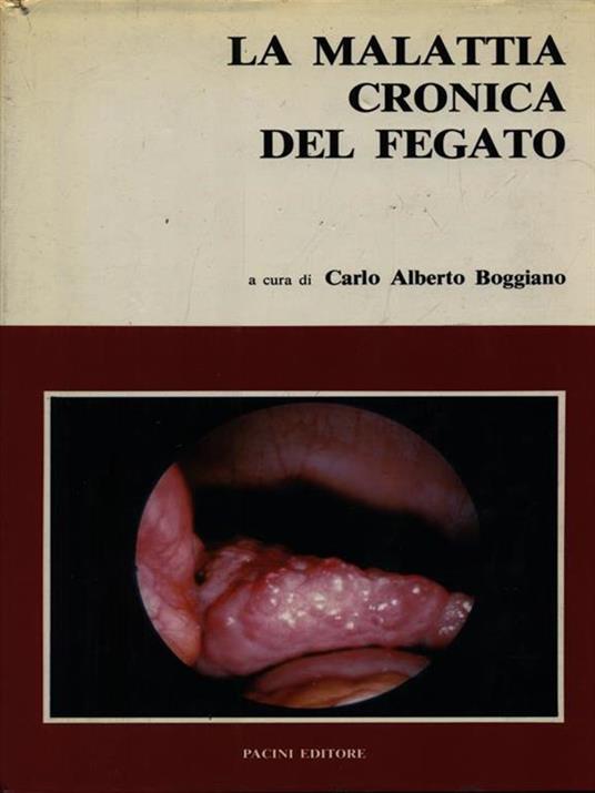 La malattia cronica del fegato - copertina