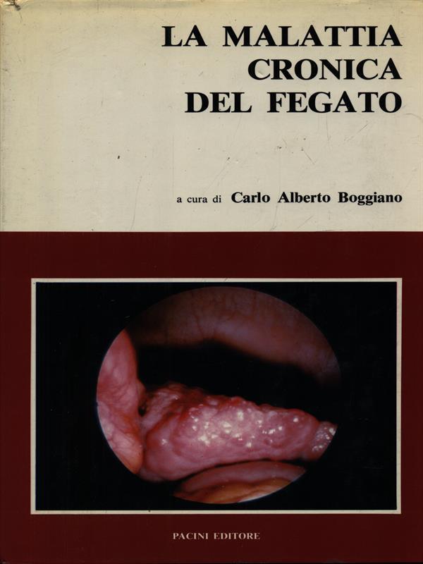 La malattia cronica del fegato