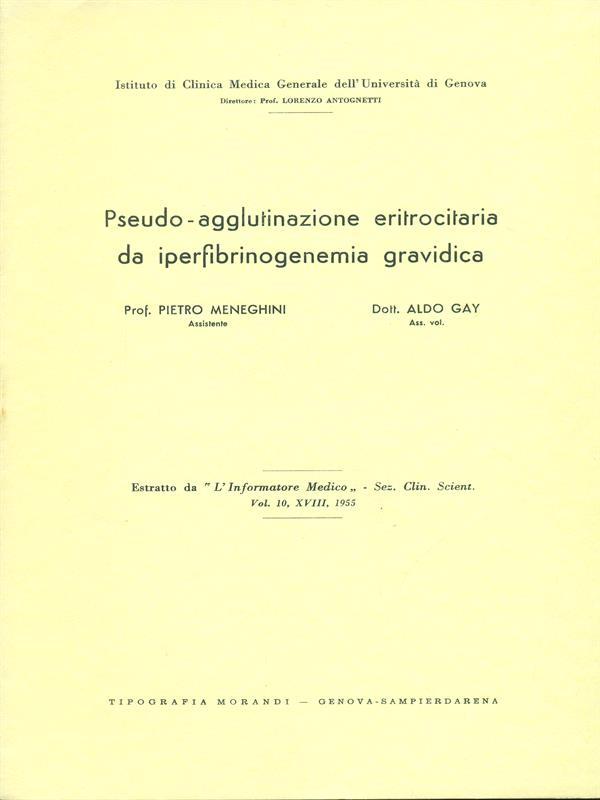 Pseudo-agglutinazione eritrocitaria da iperfibrinogenemia gravidica