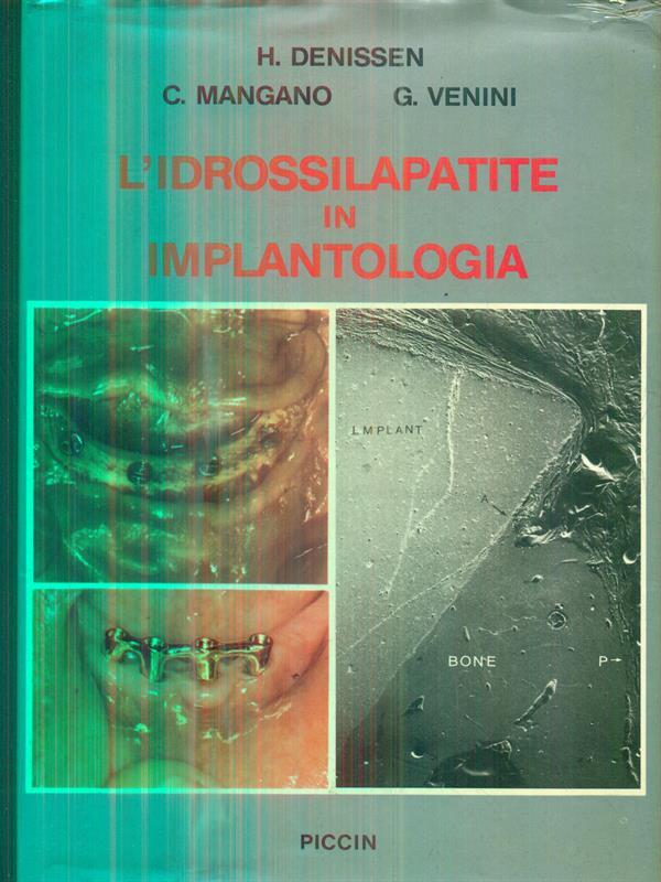 L' Idrossilapatite in Implantologia