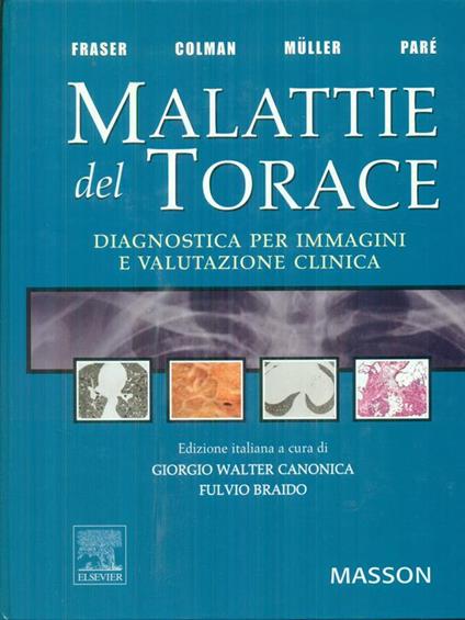 Malattie del torace - copertina