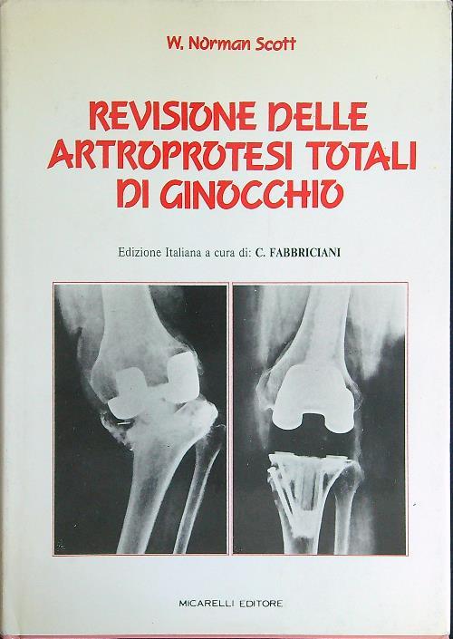 Revisione delle artroprotesi totali di ginocchio