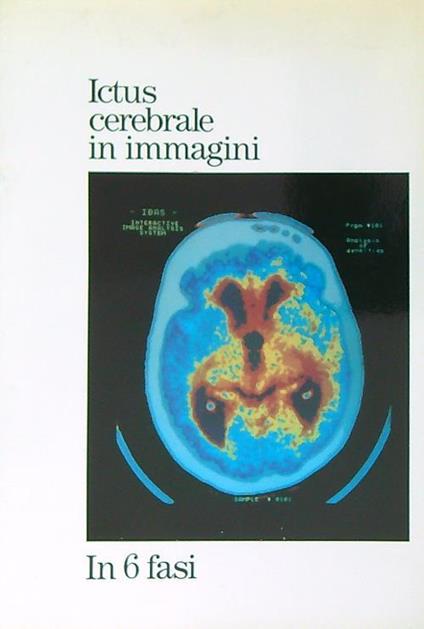 Ictus cerebrale in immagini. In 6 fasi - copertina