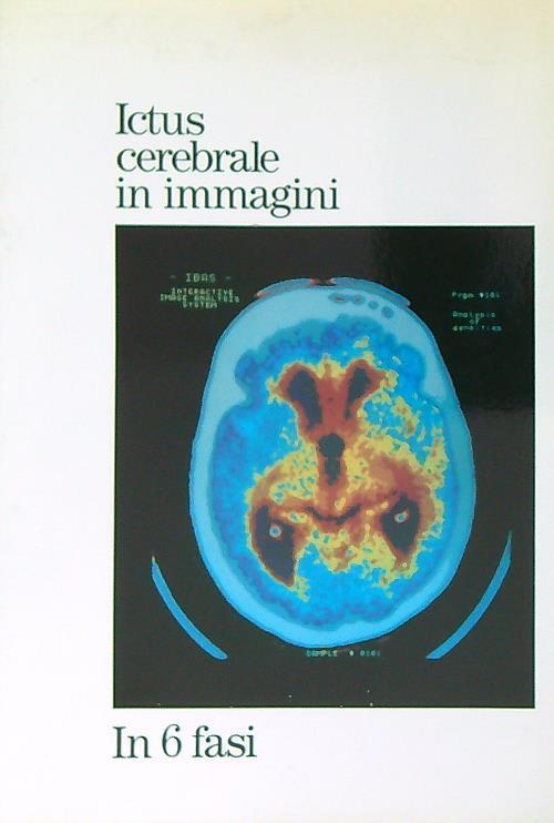 Ictus cerebrale in immagini. In 6 fasi - copertina