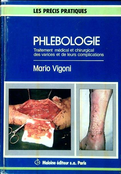 Phlébologie - M. Vigoni - copertina