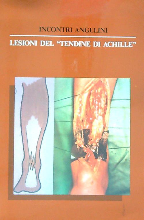 Lesioni del tendine di Achille