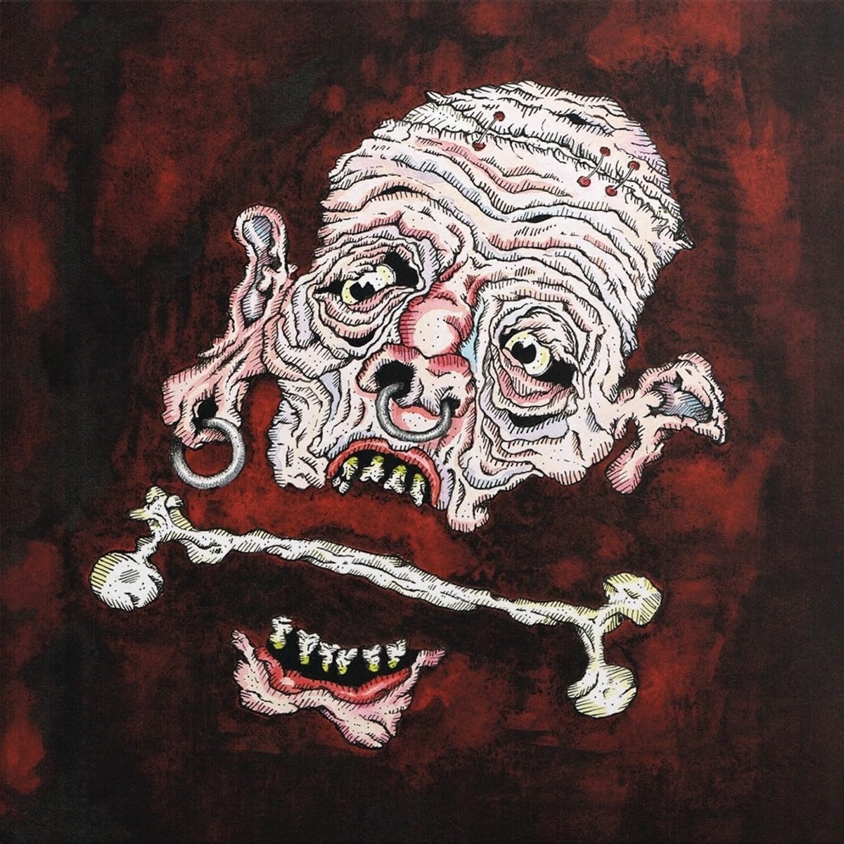 ibs
