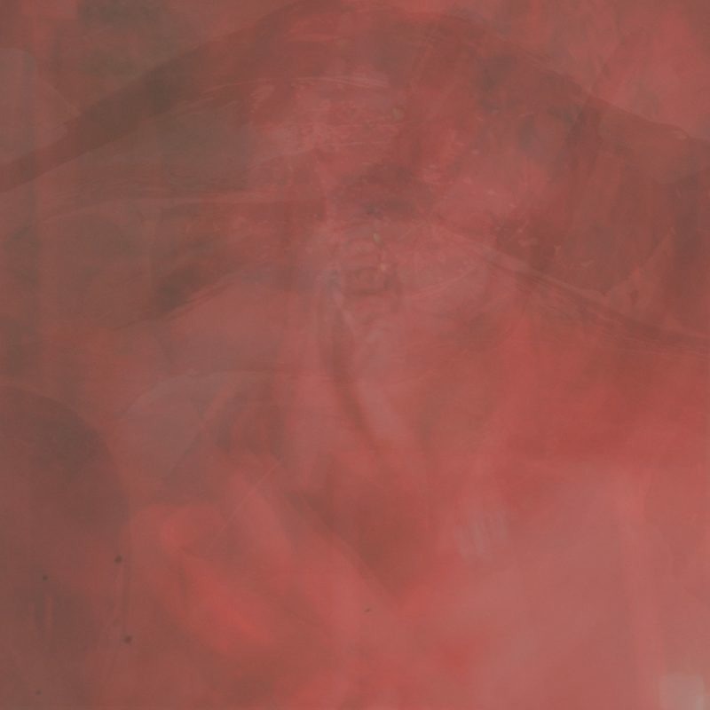 ibs