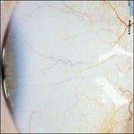 So Much Laxness - CD Audio di Minus