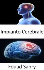 Impianto Cerebrale