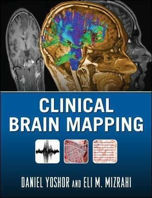 Clinical brain mapping - Daniel Yoshor,Eli M. Mizrahi - copertina