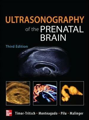 Ultrasonography of the prenatal & neonatal brain - copertina