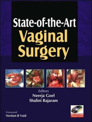 Vaginal surgery - Neerja Goel - copertina