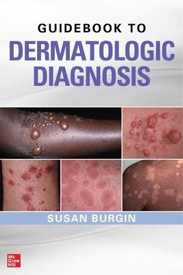 Guidebook to Dermatologic Diagnosis - Susan Burgin - cover