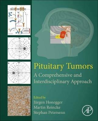Pituitary Tumors: A Comprehensive and Interdisciplinary Approach - cover