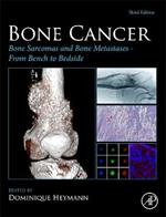 Bone Cancer: Bone Sarcomas and Bone Metastases From Bench to Bedside