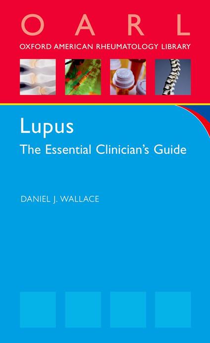 Lupus