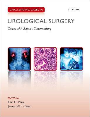 Challenging Cases in Urological Surgery - cover