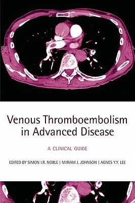 Venous Thromboembolism in Advanced Disease: A clinical guide - cover