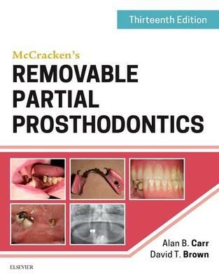 McCracken's Removable Partial Prosthodontics - Alan B. Carr,David T. Brown - cover