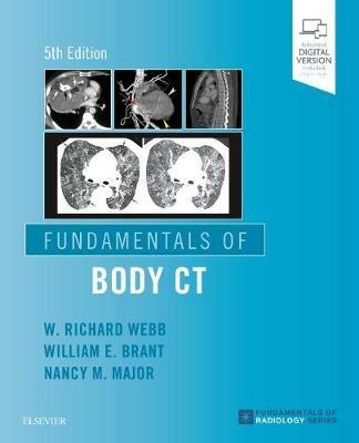 Fundamentals of Body CT - W Richard Webb,Wiliam E. Brant,Nancy M. Major - cover