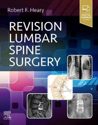 Revision Lumbar Spine Surgery - cover