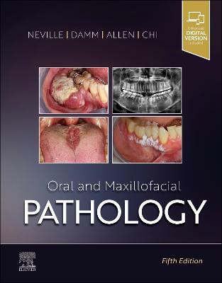 Oral and Maxillofacial Pathology - Brad W. Neville,Douglas D. Damm,Carl M. Allen - cover