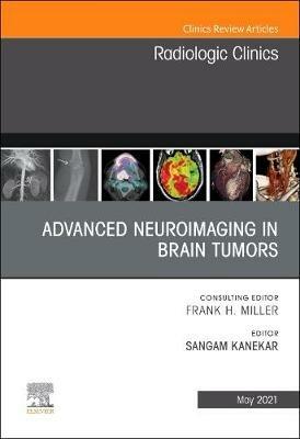 Advanced Neuroimaging in Brain Tumors, An Issue of Radiologic Clinics of North America - cover