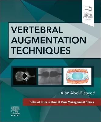 Vertebral Augmentation Techniques - cover