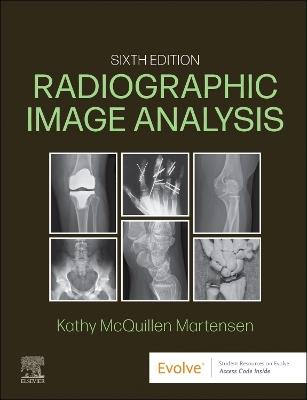Radiographic Image Analysis - Kathy McQuillen Martensen - cover