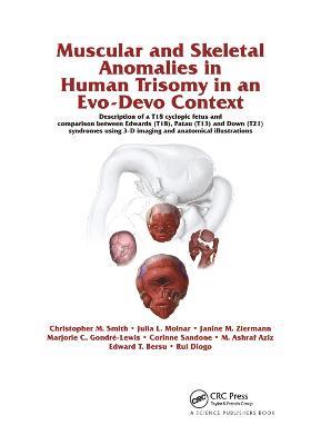 Muscular and Skeletal Anomalies in Human Trisomy in an Evo-Devo Context: Description of a T18 Cyclopic Fetus and Comparison Between Edwards (T18), Patau (T13) and Down (T21) Syndromes Using 3-D Imaging and Anatomical Illustrations - Rui Diogo,Christopher M. Smith,Janine M. Ziermann - cover