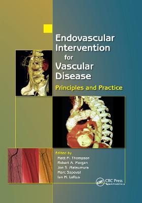 Endovascular Intervention for Vascular Disease: Principles and Practice - cover