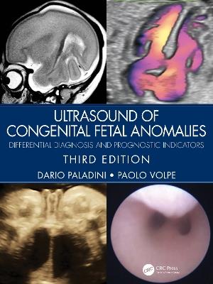 Ultrasound of Congenital Fetal Anomalies: Differential Diagnosis and Prognostic Indicators - Dario Paladini,Paolo Volpe - cover