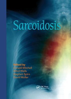 Sarcoidosis - cover