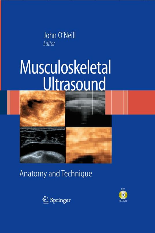 Musculoskeletal Ultrasound