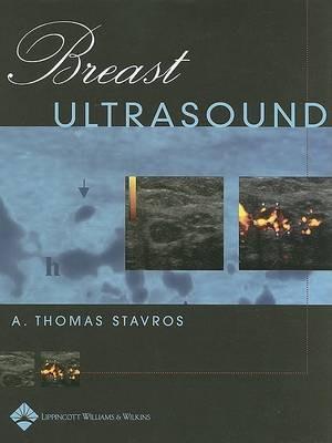 Breast Ultrasound - A. Thomas Stavros - cover