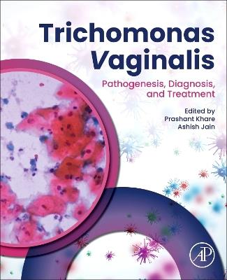 Trichomonas vaginalis: Pathogenesis, Diagnosis, and Treatment - cover