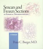 Smears and frozen sections in surgical neuropathology. A manual