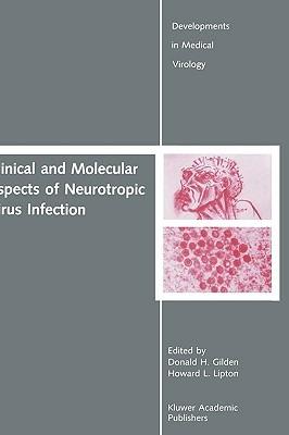 Clinical and Molecular Aspects of Neurotropic Virus Infection - cover