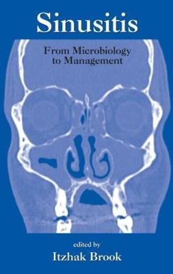 Sinusitis: From Microbiology To Management - cover
