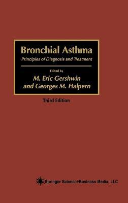 Bronchial Asthma: Principles of Diagnosis and Treatment - cover