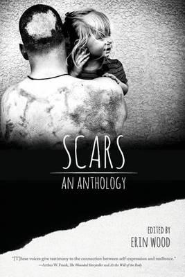 Scars: An Anthology - cover