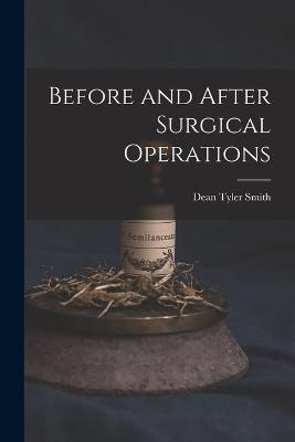 Before and After Surgical Operations - Dean Tyler Smith - cover