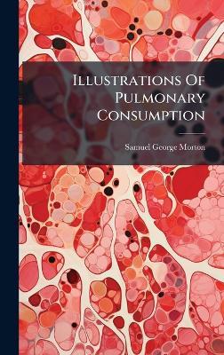 Illustrations Of Pulmonary Consumption - Samuel George Morton - cover