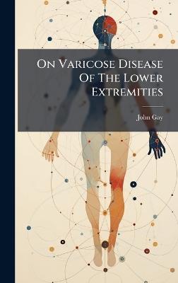 On Varicose Disease Of The Lower Extremities - John Gay - cover
